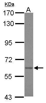 Asparagine synthetase Antibody
