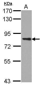 PKC epsilon Antibody
