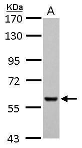 Pyruvate Kinase (liver/RBC) Antibody