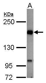 TIE2 Antibody