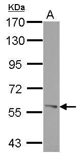 ROR alpha Antibody