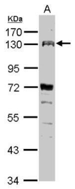 FGFR4 Antibody