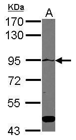 ATP2C1 Antibody