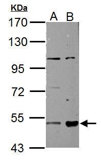 ALDH3A2 Antibody