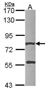 beta Amyloid Antibody
