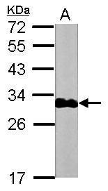Troponin I (cardiac) Antibody