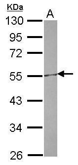 CETP Antibody
