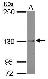 JAK1 Antibody