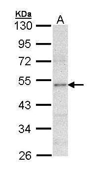 LPL Antibody