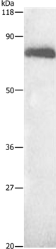 ALB Antibody