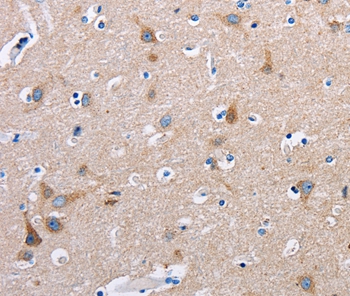 FN1 Antibody
