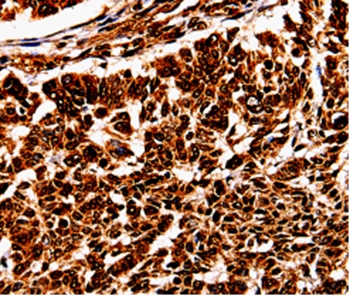 BOLL Antibody