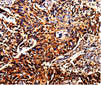 DAZ4 Antibody