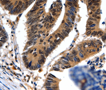 NEFL Antibody