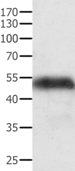 ACPP Antibody