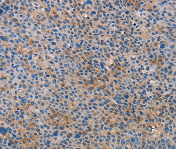 ALOX15B Antibody