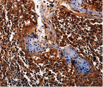 ALPL Antibody