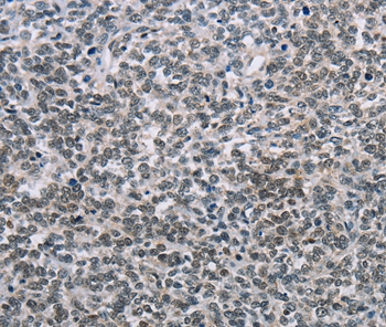 TONSL Antibody