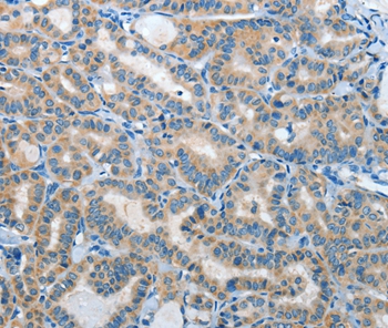 IL21R Antibody