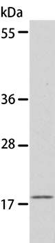 EIF4EBP1 Antibody
