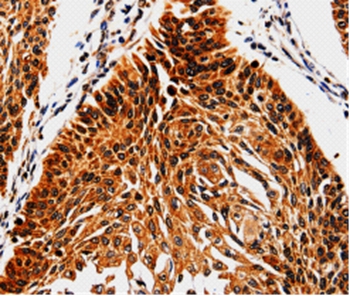 ABCB5 Antibody