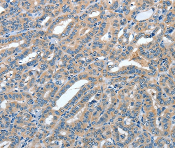 ANGPT1 Antibody