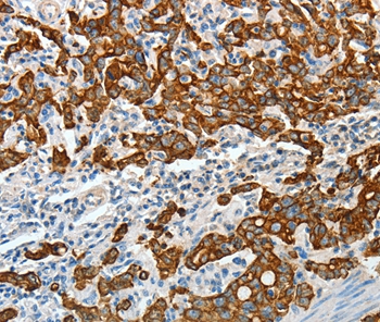 KRT18 Antibody