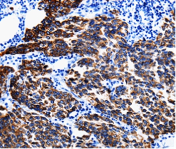 KRT6A Antibody