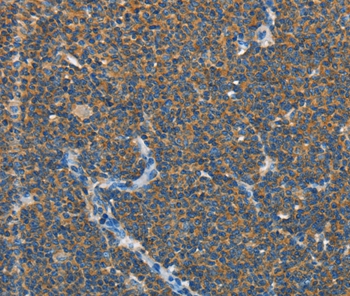 SEPT9 Antibody