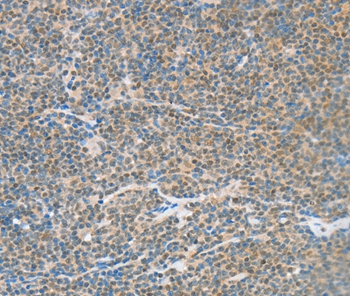 ATF2 Antibody