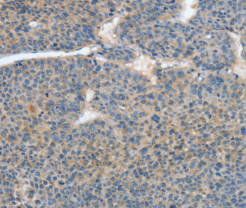 ATP4B Antibody