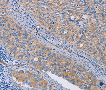 CAPN7 Antibody