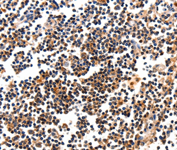 CAMK1 Antibody