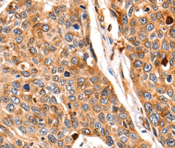 CTSB Antibody