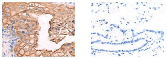 CEACAM8 Antibody
