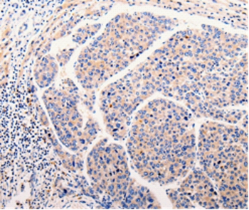 CLEC10A Antibody