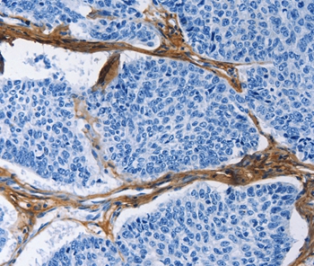 COL3A1 Antibody
