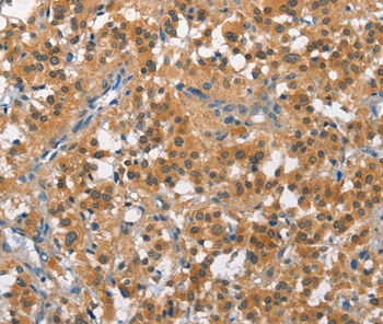 CUL7 Antibody