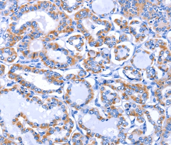 GJB3 Antibody