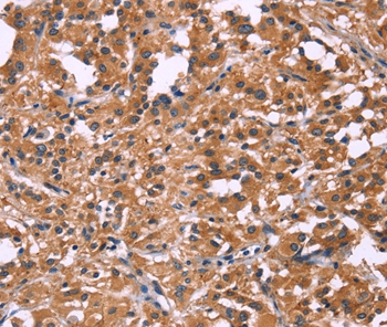DKK4 Antibody