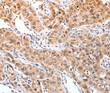 DPPA2 Antibody