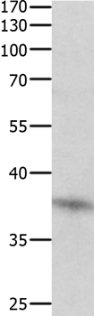 DUSP12 Antibody