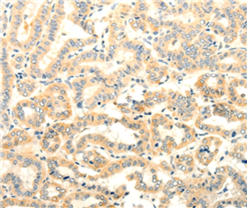FOXR2 Antibody