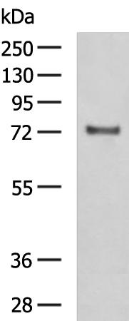 FSHR Antibody