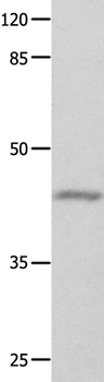 GNA11 Antibody