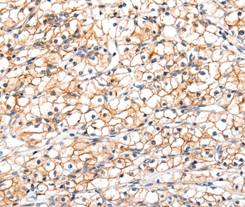 GLP1R Antibody