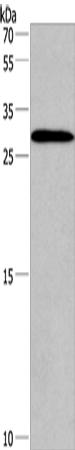 IRAK1BP1 Antibody