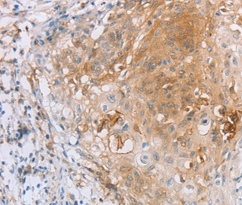 LILRB2 Antibody