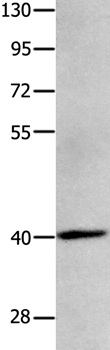 MAGEB4 Antibody