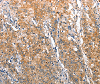 ST14 Antibody
